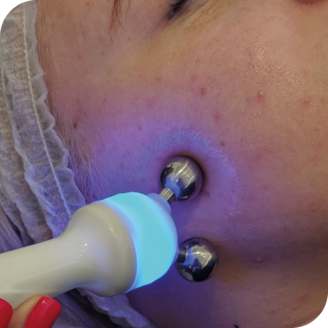 HO2-Page_Carousel-Electro-Ion-Image