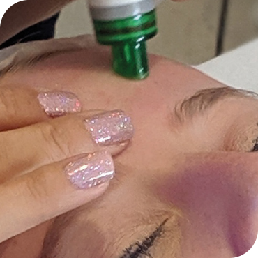 HO2-Page_Carousel-Hydro-Peel-Image