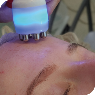 HO2-Page_Carousel-Skin-Tightening-Image