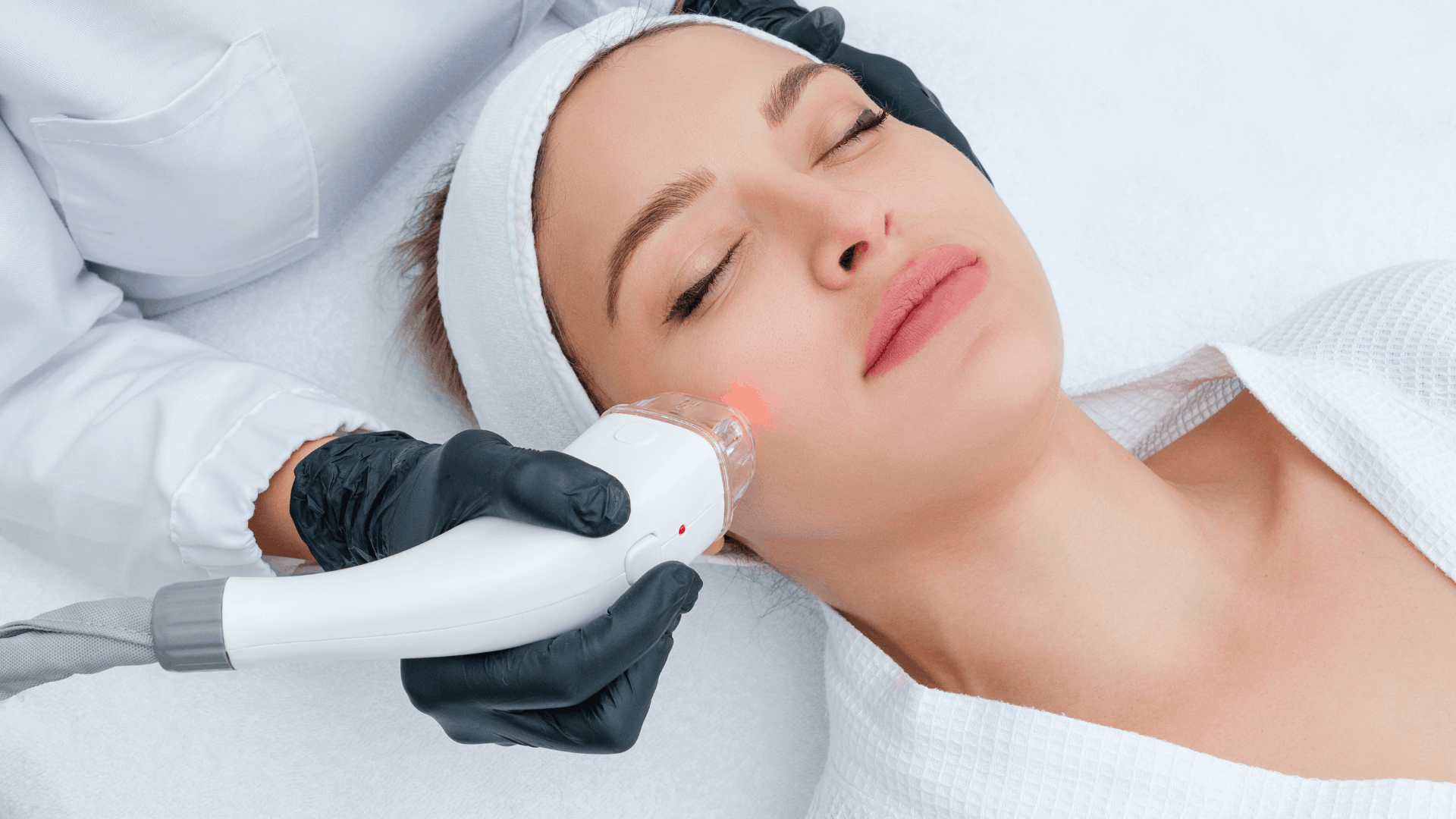 Read more about the article Best Acne Treatments at a Skin Clinic in Waterloo